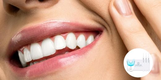 Como manter os dentes brancos após usar um kit de clareamento?