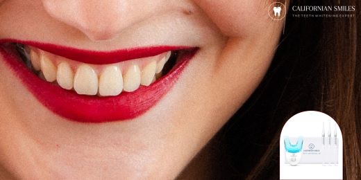 O clareamento dental caseiro é seguro para meus dentes?